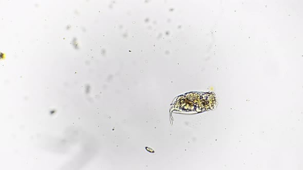 Macro View of Dying Rotifer Filmed with High Magnification Under Lab ...