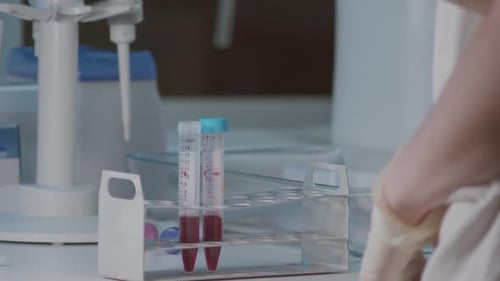 Laboratory scientist grabbing test tubes with blood from holder and marking it, closeup view