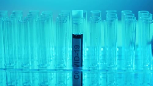 Laboratory Tubes with Blood and Virus Closeup of Scientific Lab in Hospital Epidemic Disease