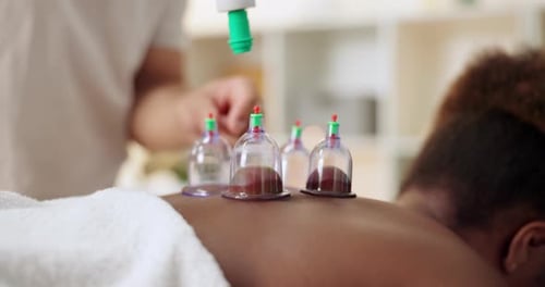 Spa, cupping therapy and back of person for massage treatment, body or muscle pain with vacuum cups