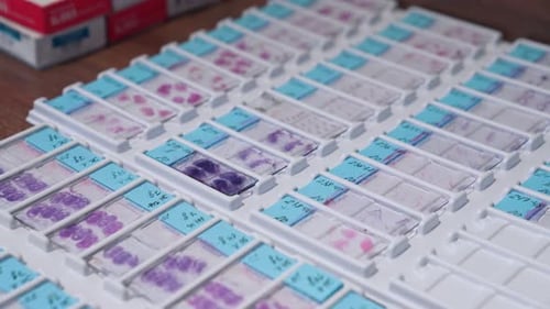 Prepared Microscope Slides in Lab for Medical Analysis