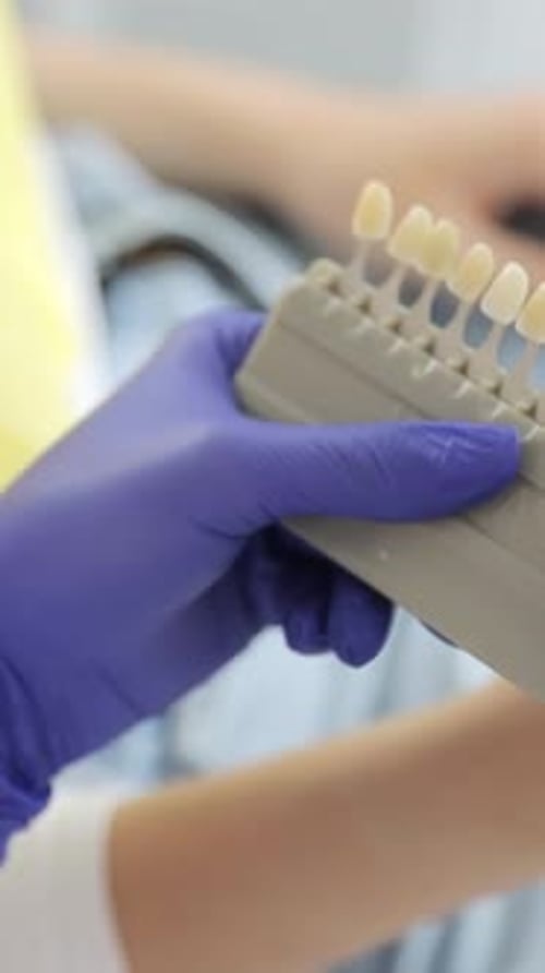 Dentist Checks Tooth Shade Samples in Clinic