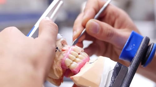 A dentist making a dental prosthesis