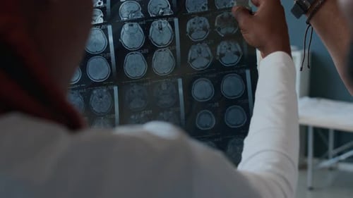 Neurologist Demonstrating MRI Scan of Head to Male Patient in Hospital