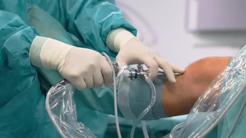 Surgeon Performing Knee Arthroscopy Operation in Hospital With Viewing Scope Instruments Inserted