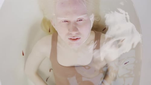 Girl With Albinism Relaxing In Bathtub