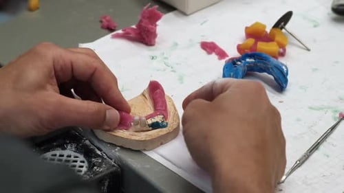 Dental Technician Crafting Precision Dental Mold