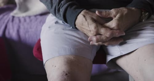 Senior Adult Shows Scar From Knee Surgery