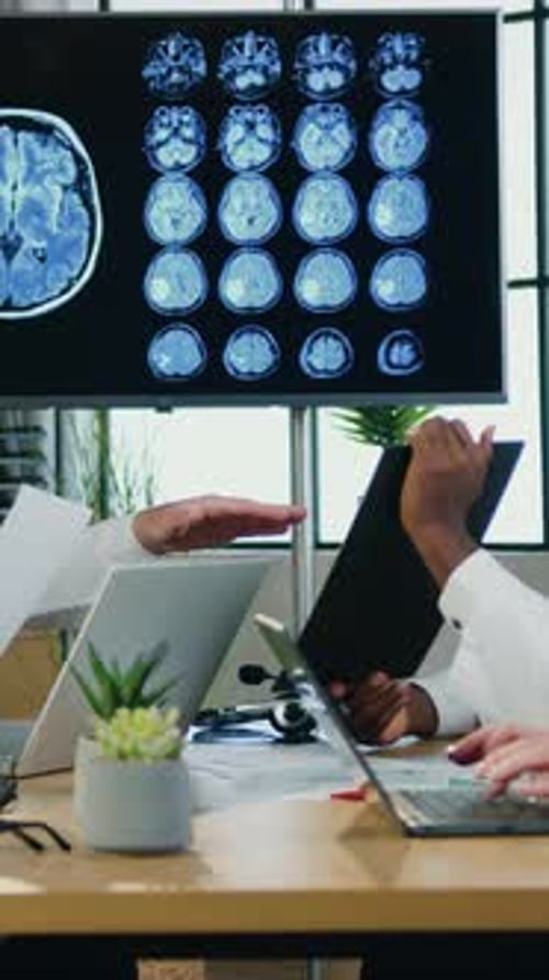 Medical Professionals Analyzing Brain Scans at Office