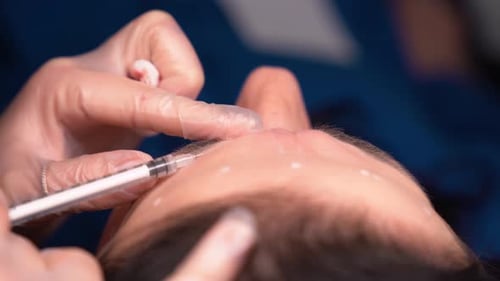 Beautician Doctor Makes Botox Injection in the Forehead of Young Beautiful Woman Extreme Close Up