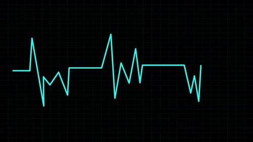 Neon Blue Heartbeat EKG Monitor Line Over Digital Grid