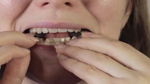 Detailed TMJ Anatomy with Jaw Movement 3D Animation, Backgrounds Motion ...