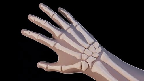 Hand Skeleton with Progressive Bone Disease 3D Animation