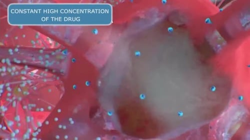 3D Medical Animation of Targeted Drug Delivery in Neurons