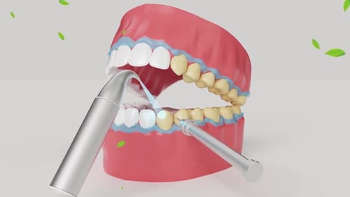 3D Animation of Dental Teeth Cleaning and Whitening Process