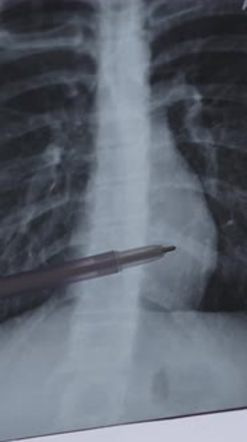 Anatomy