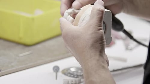 Dentist Adjusting a Dental Mold with a Drill