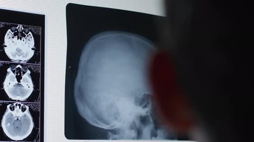 Medical Professional Analyzing Medical X-Rays