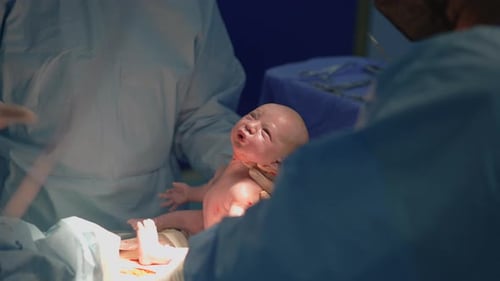 A Newborn Baby is Carefully Lifted From the Mother's Belly During a Cesarean Section Operation A