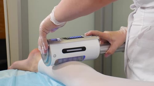 Aesthetic Laser Therapy on Leg in Clinic