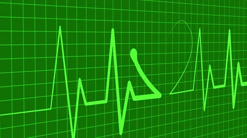 Animated Heartbeat Line with EKG Monitor Display