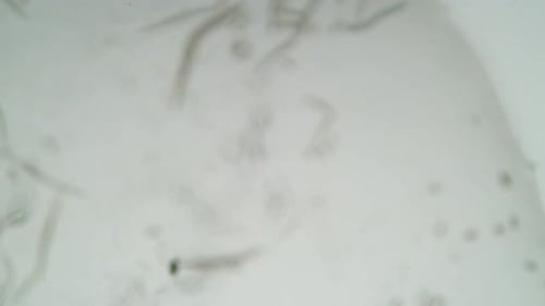 Contagion Collection: Microscopic worms with the sliding motion over a white background
