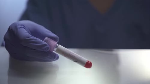 Close-up of nurse holding positive Coronavirus blood test.