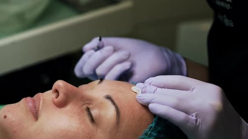 Blackheads removal procedure at cosmetologist’s.