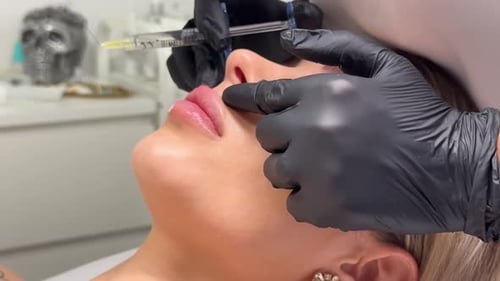 Close Up Lip Filler Procedure in Medical Spa