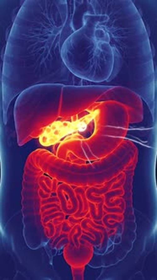 3D Medical Scan of Human Pancreas and Intestine Pain