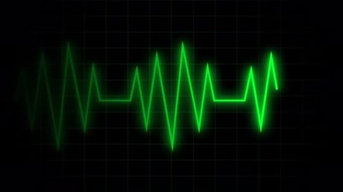 Neon Green Heartbeat Line on Grid Background