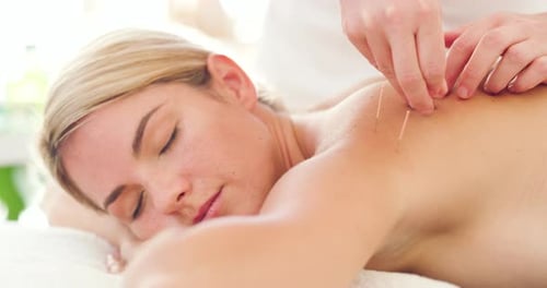Gros plan sur les mains d'un acupuncteur soignant un jeune patient caucasien dans une clinique