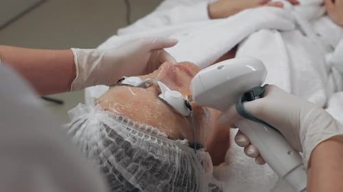 Skin Treatment Process Using a Laser Device at a Clinic