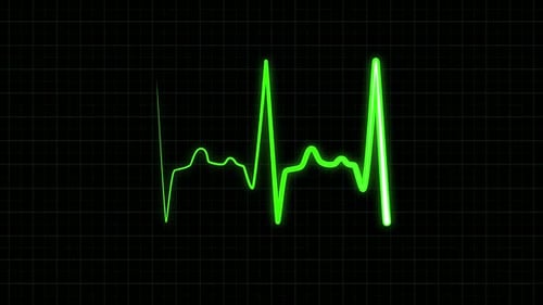 Heart Rate Monitoring During a Medical Examination Process