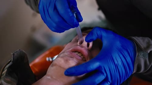 Closeup a Confident Male Medic with His Own Hands in Blue Medical Rubber Gloves Inserts a Breathing
