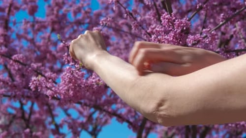 Frau mit juckender Hand am Baum