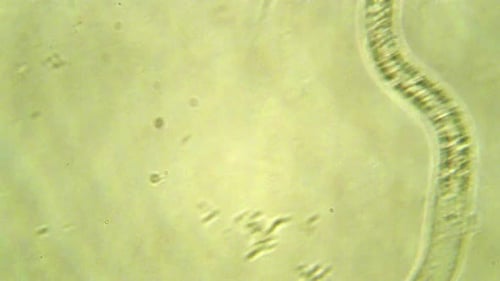 Collection Contagion : queue de ver microscopique isolée à focalisation molle