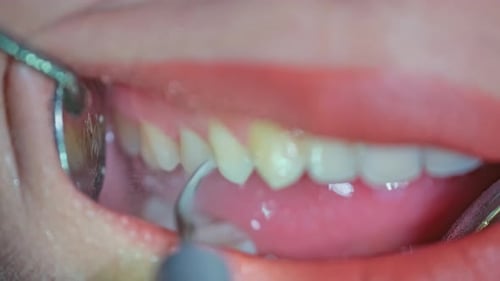 Patient Teeth