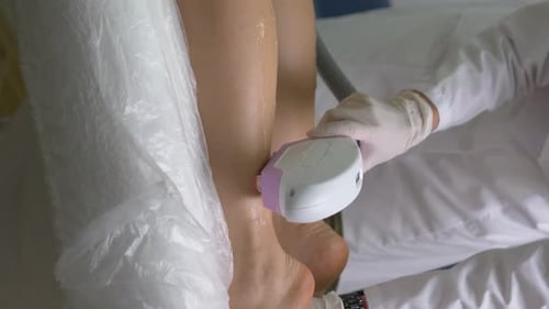 Laser Epilation Treatment at a Medical Spa