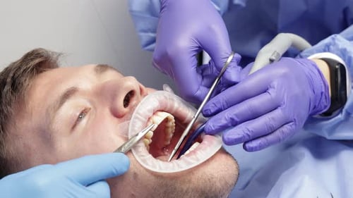 Man Having Teeth Cleaned by Dental Professionals