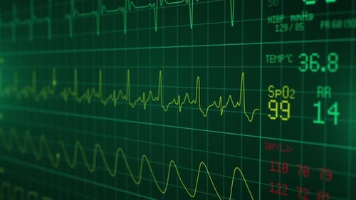 Patient Monitor Displays Vital Signs ECG Electrocardiogram EKG Oxygen Saturation SPO2 and