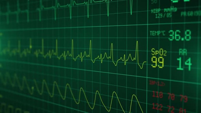 Patient Monitor Displays Vital Signs ECG Electrocardiogram EKG Oxygen ...