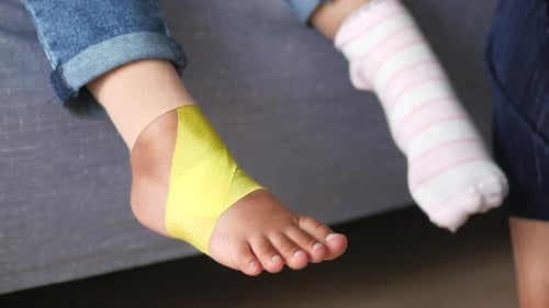Cinta elástica terapéutica azul aplicada a la cinesiología de las piernas de un niño para la terapia de lesiones