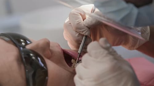 Nahaufnahme eines Patienten, dessen Zähne während eines Zahnarzttermins untersucht wurden