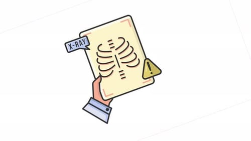 Flat Design Hand Holding Medical X-Ray Scan Document Animation