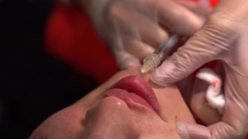 Lip Injection Procedure Close Up, Health and Beauty