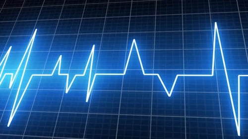 Heartbeat