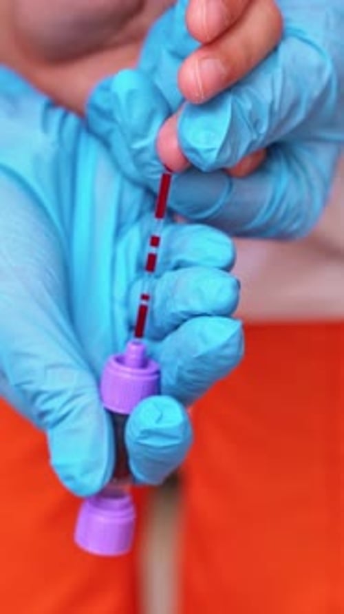 Doctor testing of patient blood. Close up view of hands doctor testing his patients blood