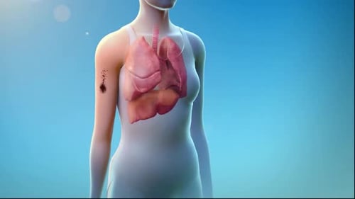 Human Lungs Anatomy with Spreading Dark Particles Animation