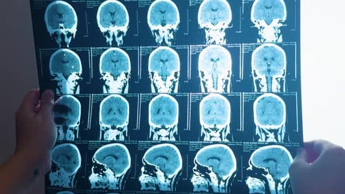 Brain Scan Medical Imaging in Hospital Close Up
